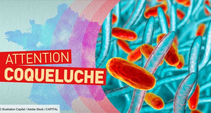 epidemie-alerte-sur-lexplosion-des-cas-de-coqueluche-en-france-1495577.jpg